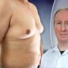 “Manboobs komen 40% meer voor dan vroeger”: expert legt uit hoe je ervan verlost raakt