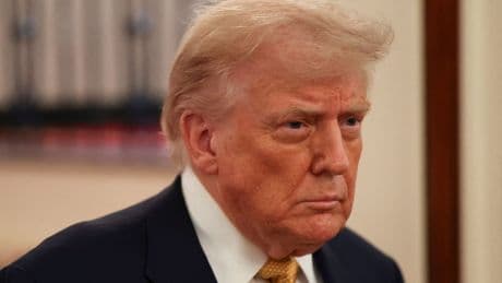Donald Trump ist krank: US-Präsident mit Venenschwäche diagnostiziert