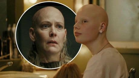 Krimi um Haarklau! - So bekamen die „Tatort“-Stars Glatzen