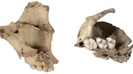Se descubre un nuevo caso de canibalismo en Atapuerca no relacionado con rituales: "A veces era por puro desprecio"