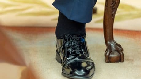 What is chronic venous insufficiency?