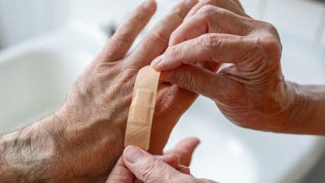 Biggest mistake when treating a wound is letting it ‘dry out’, TV doc says
