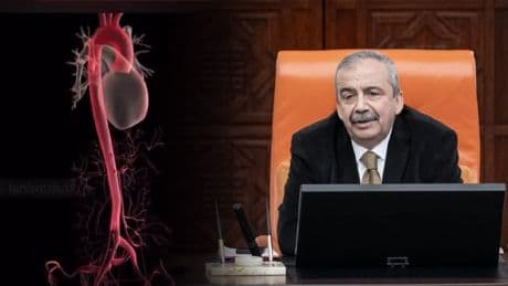 Aort nedir ve anevrizma nasıl oluşur? Sırrı Süreyya Önder'in sağlık durumu gündemde: Prof. Dr. Sönmez anlattı