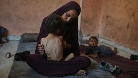 Dozens of kids and adults in Gaza have starved to death in July as hunger surges