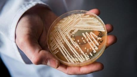 Tödlicher Pilz Candida auris alarmiert weltweit Experten
