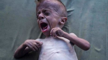 La famine à Gaza officiellement déclarée par l’ONU : Israël préfère dénoncer « les mensonges du Hamas »