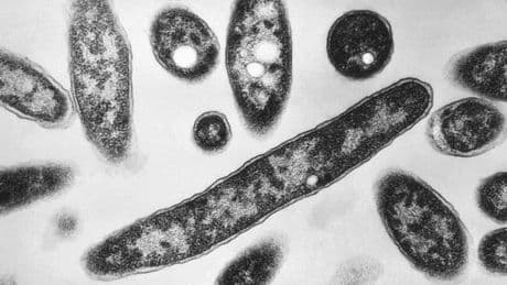 One dead and 22 sick from Legionnaires’ cluster in New York, health officials say