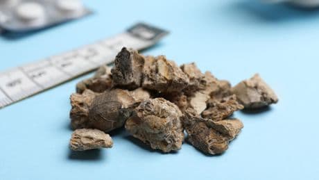 Calculs rénaux: les promesses d’une bactérie mangeuse de calcium implantée dans l’intestin