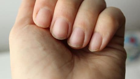 El aspecto de tus uñas te permite saber cuánto vivirás, según Harvard