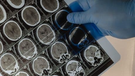 Breakthrough as scientists discover how the human brain solves new problems