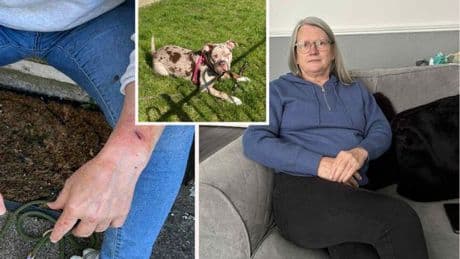 Scots woman mauled by XL-Bully 'lucky to be alive' after heroic man comes to rescue