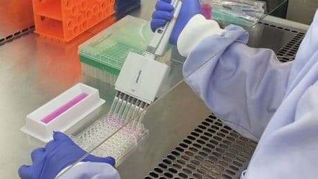Chronic UTI patients could finally see new treatment on NHS