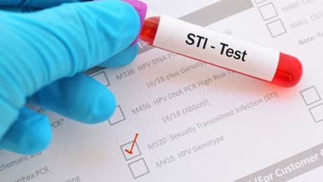 Gonorrhoea cases in Scotland remain high amid surge among older men