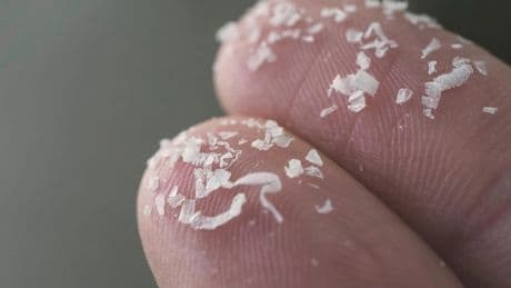 Scientists issue new warning linking microplastics with strokes