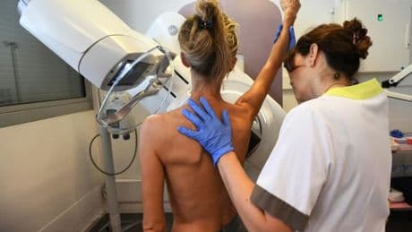 "L'espoir de gagner un temps précieux": un médicament ralentissant le cancer du sein autorisé au Royaume-Uni