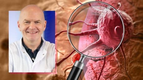 Hoffnungs-Medikamente erwartet  - Top-Experte für BILD beim größten Krebskongress