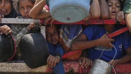 Israel und Gaza | Aufnahme von Kindern: Humanitäre Hilfe oder Wahlkampftaktik?