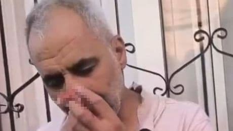 Cami müezzinini bıçaklayan şüpheli tutuklandı