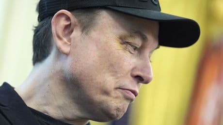Elon Musk says his 5-year-old son gave him a black eye