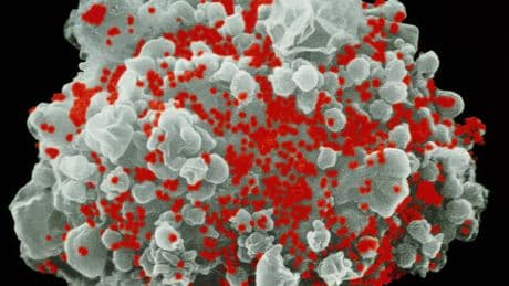 Used in Covid Shots, mRNA May Help Rid the Body of H.I.V.