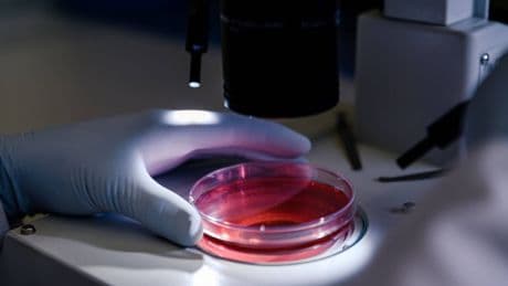 Un gen abre la puerta a un nuevo tratamiento para el cáncer de próstata más agresivo