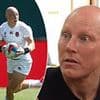 I had wigs thrown at me while I was playing rugby because of my hair loss