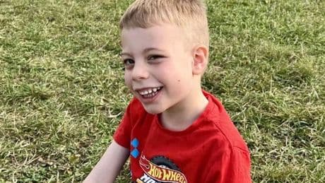 Boy, 4, one of 20 in the world with mystery condition after parents noticed odd symptoms