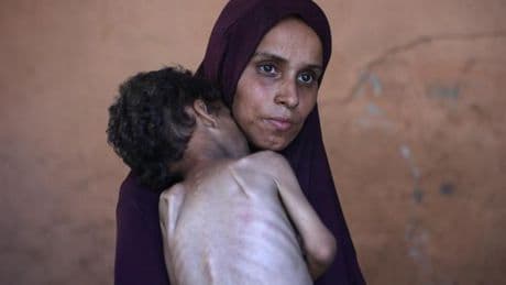 Gazze'de bir annenin feryadı: Bu hastanede 80 çocuk açlıktan öldü, kızımın 81. olmasından korkuyorum