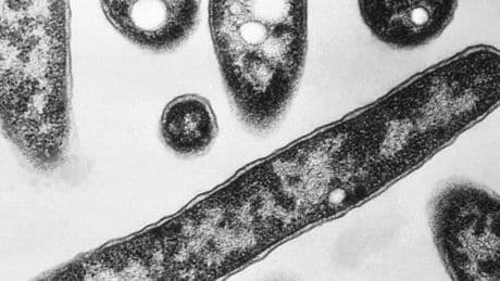 Legionnaires’ Outbreak in Harlem Kills 2 and Sickens More Than 50