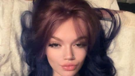 'My cracked tooth left me shaking and vomiting – it nearly killed me'