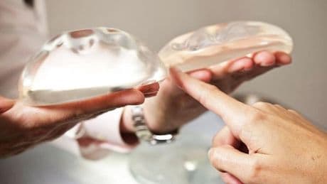 Sanidad confirma 102 casos de un raro linfoma vinculado con prótesis de mama implantadas desde hace una década