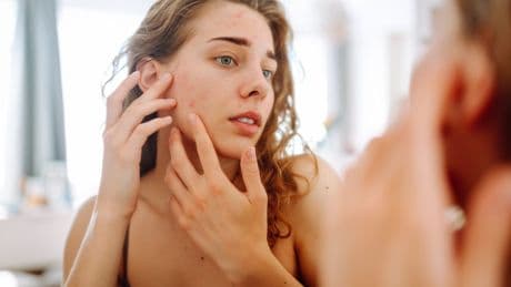 Hitzepickel: Ursachen, Symptome, Behandlung und Vorbeugung