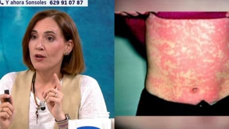 ¿Ibuprofeno, omeprazol, perfume? Boticaria García te explica por qué podrían arruinarte el verano: “Puedes quemarte sin darte cuenta”