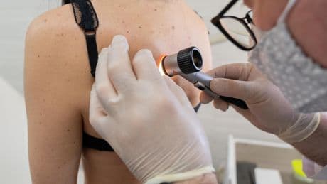 Pourquoi les cas de cancer de la peau ont triplé en France en 30 ans