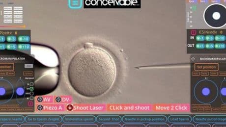 Premier bébé conçu par une FIV pilotée par l’intelligence artificielle