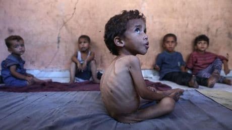 Warnung vor „Massenhungersnot“ – Koalition bei Gaza-Frage uneins