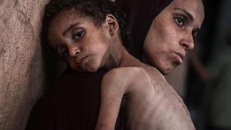 Gazze’de açlıktan ölen çocukları görmezden geldi! İsrailli bakandan küstah açıklama: Öyle bir şey yok