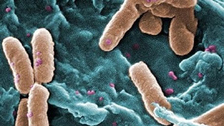 &quot;Asombroso&quot; hallazgo en Madrid: encuentran millones de bacterias tras treinta años encerradas en un entorno tóxico