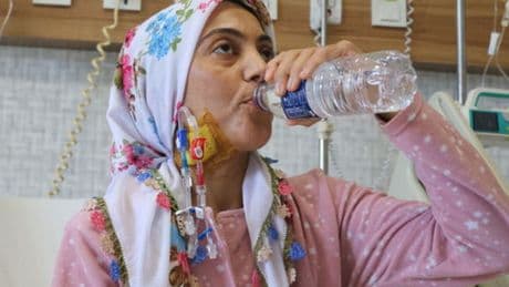 Beş böbrekle yaşıyor