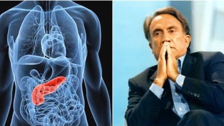Emilio Fede e il tumore al pancreas: la diagnosi "sbagliata", gli esami del sangue ogni 3 mesi e la depressione. Sintomi, cause e consigli oncologo