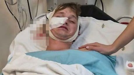 Stag do reveller brutally mauled by HYENAS after heavy night drinking