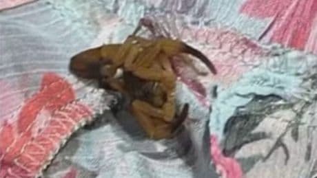 Student, 20, is stung by SCORPION in Zara changing room sparking terrifying hospital dash