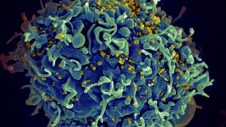 UN says if US funding for HIV programs is not replaced, millions more will die by 2029