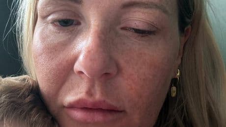 Toxic beauty product causes outbreak of rare deadly disease leaving patients ‘frozen’