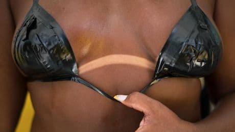 « Tan lines » et « burn lines » : le ministre de la santé met en garde contre des bronzages dangereux popularisés sur les réseaux
