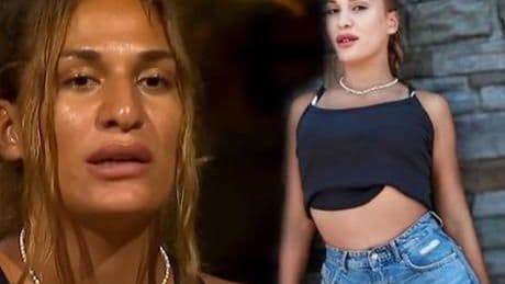Survivor Almeda burun ameliyatı oldu! İşte Survivor Almeda'nın son hali