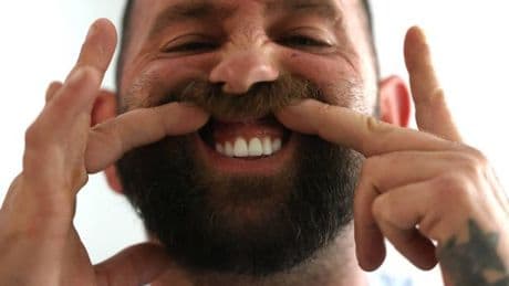 Getting his teeth done in Turkey was 'worst mistake' - now he owes £100k