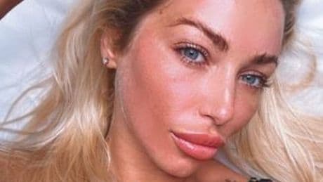 'My affair with Thomas Skinner was no fling - he introduced me as his girlfriend'
