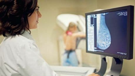 Cancro al seno, la cura arriva dal gelo. Ieo: «Annientare il tumore con una sfera di ghiaccio per un futuro senza bisturi» ?