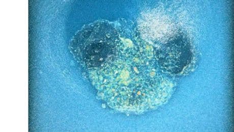 Investigadores españoles graban por primera vez la implantación de un embrión humano en tiempo real: puede mejorar la fertilidad